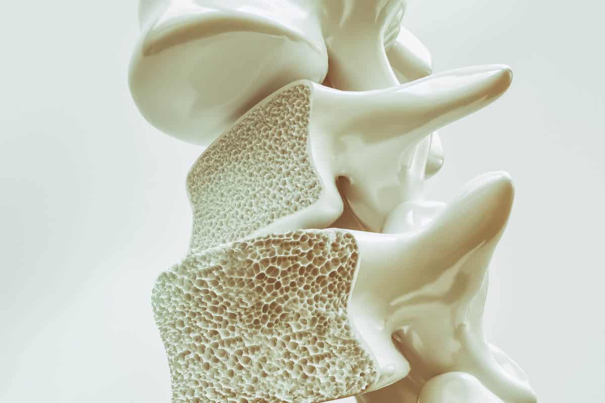 Is Resistance Training Good for Osteoporosis?