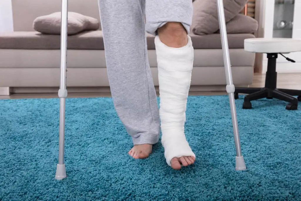 10 Great Ways to Stay Active in a Cast